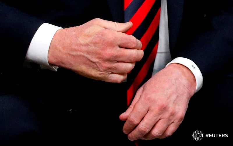 Illustration for article titled Handshake Wars: Death by Thumb (and Other Events from a Very Productive G7 Summit)